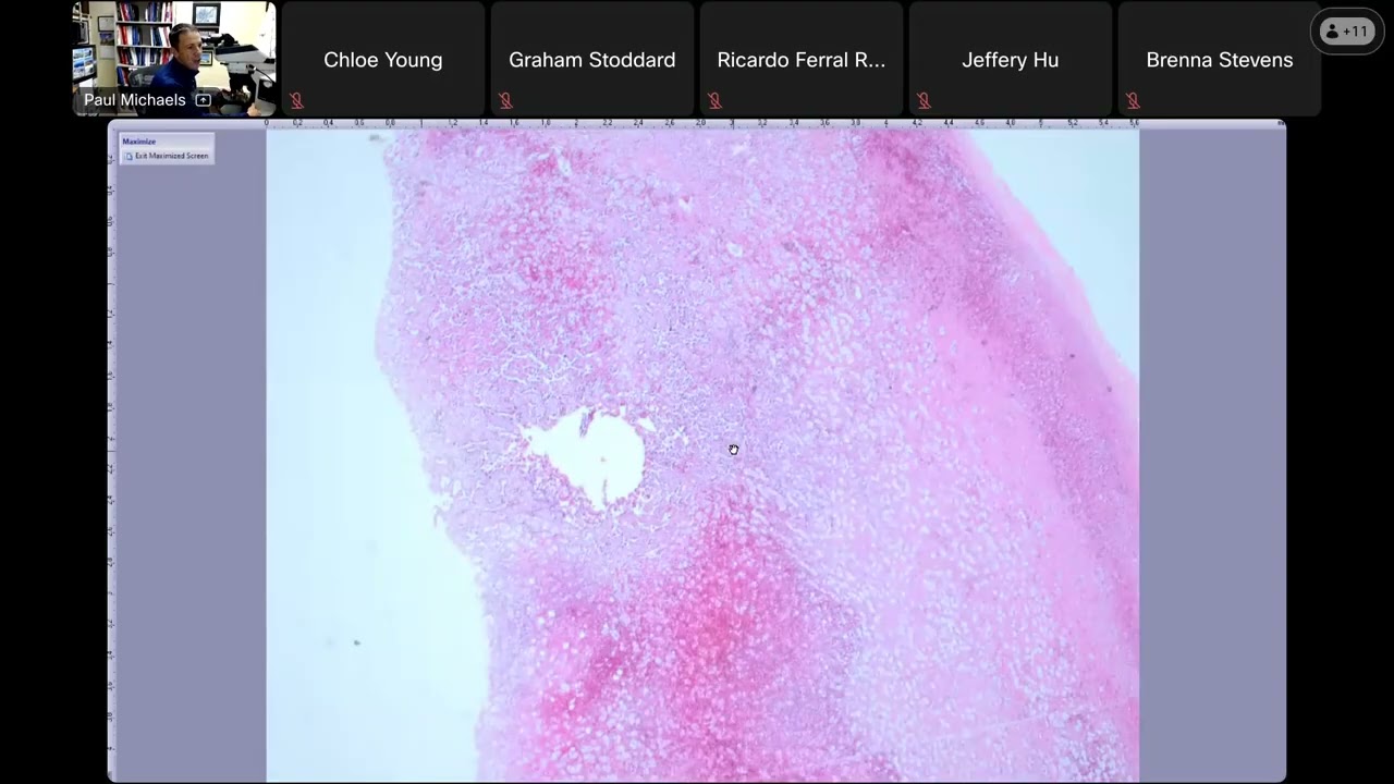 Virtual Pathology Slide Session (12/20/24) with Dr. Paul Michaels