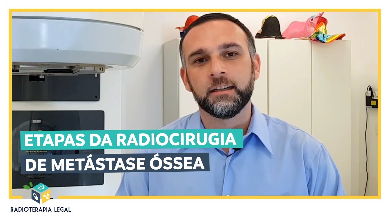 Radiocirurgia em Metástases Ósseas  - Etapas