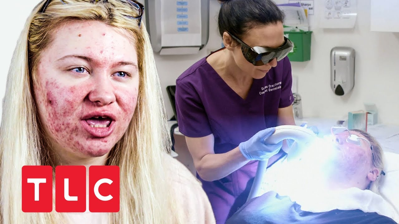 Laser gegen Akne | Dr. Emma: Haut&auml;rztin aus Leidenschaft | TLC Deutschland
