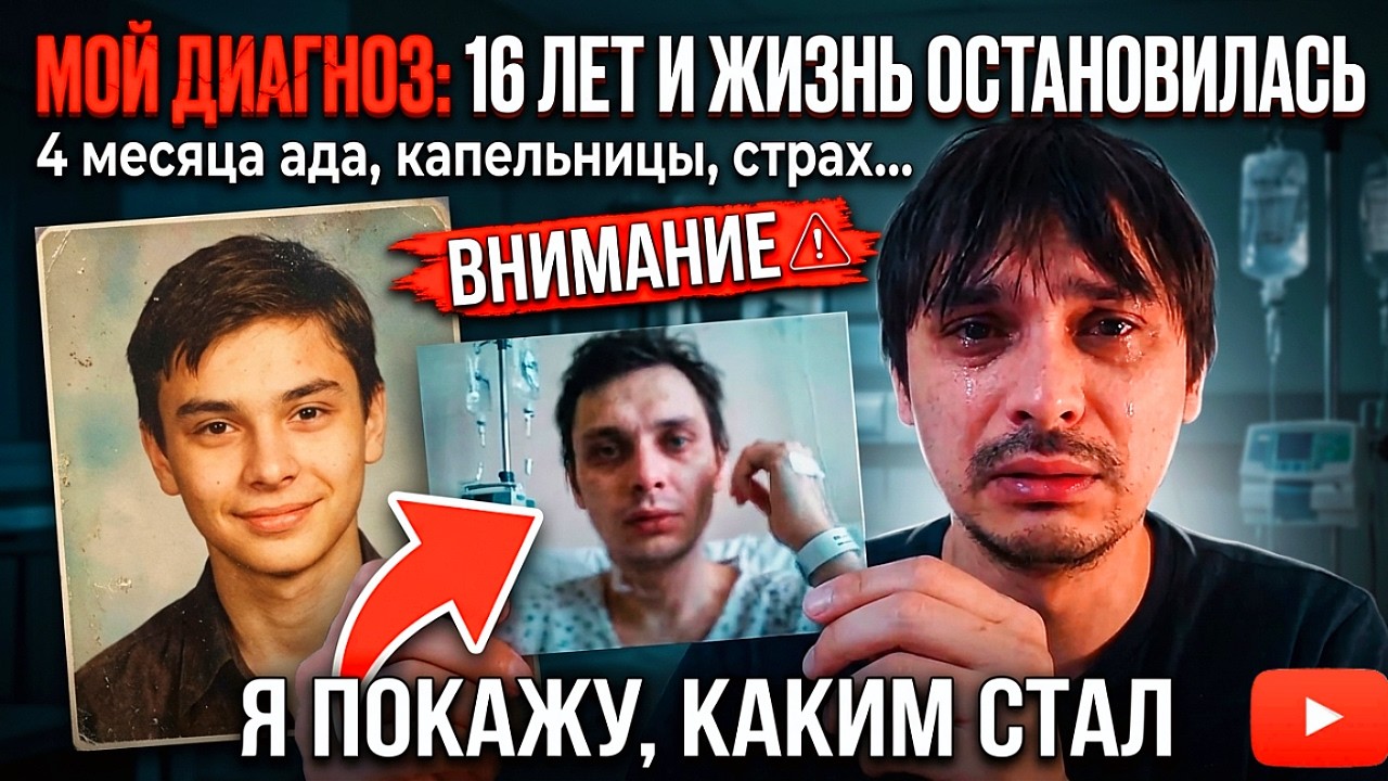 Фото, которое я боялся показывать… Что со мной стало в 16 лет