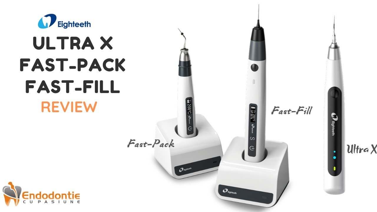 Ultra X & Fast Pack/Fast Fill Review