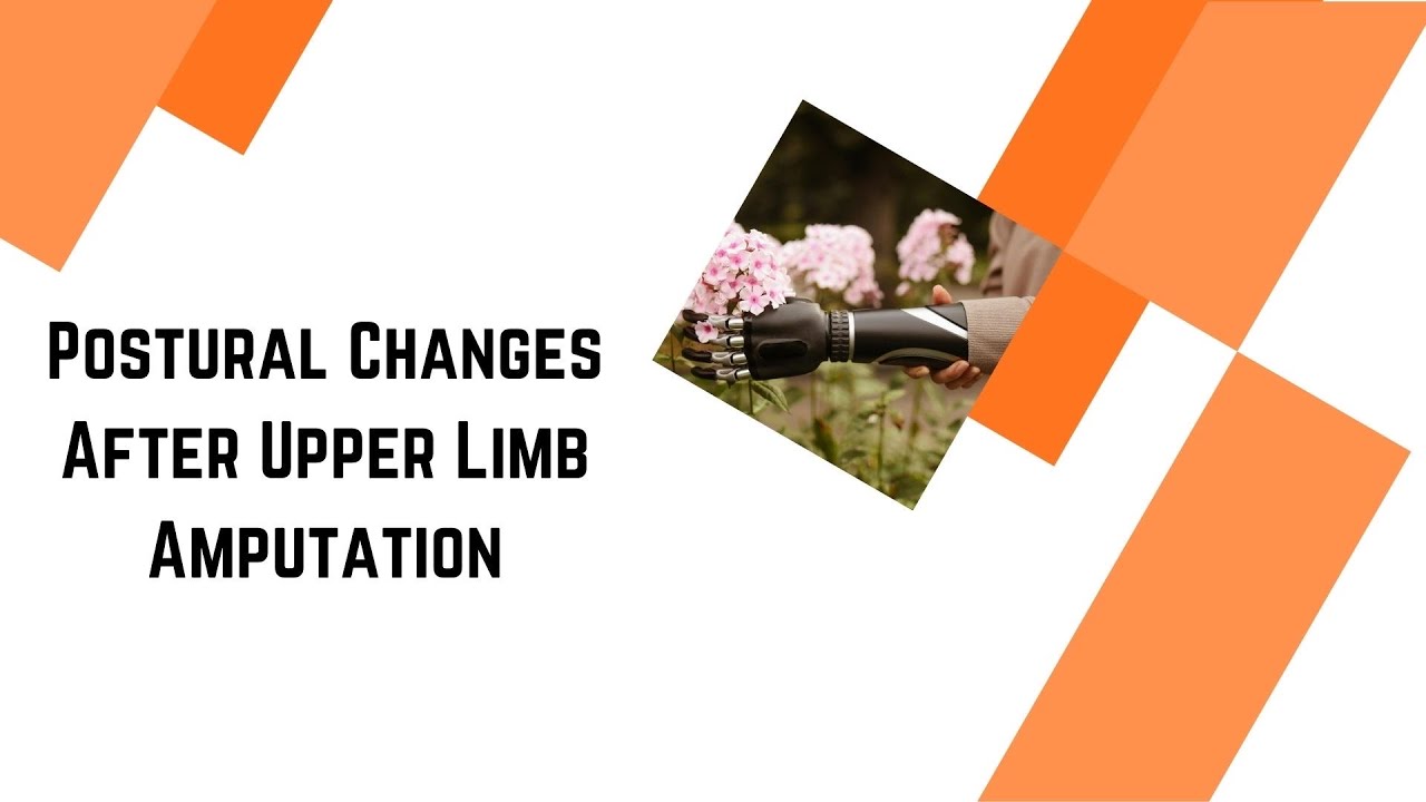 Postural Changes After Upper Limb Amputation 