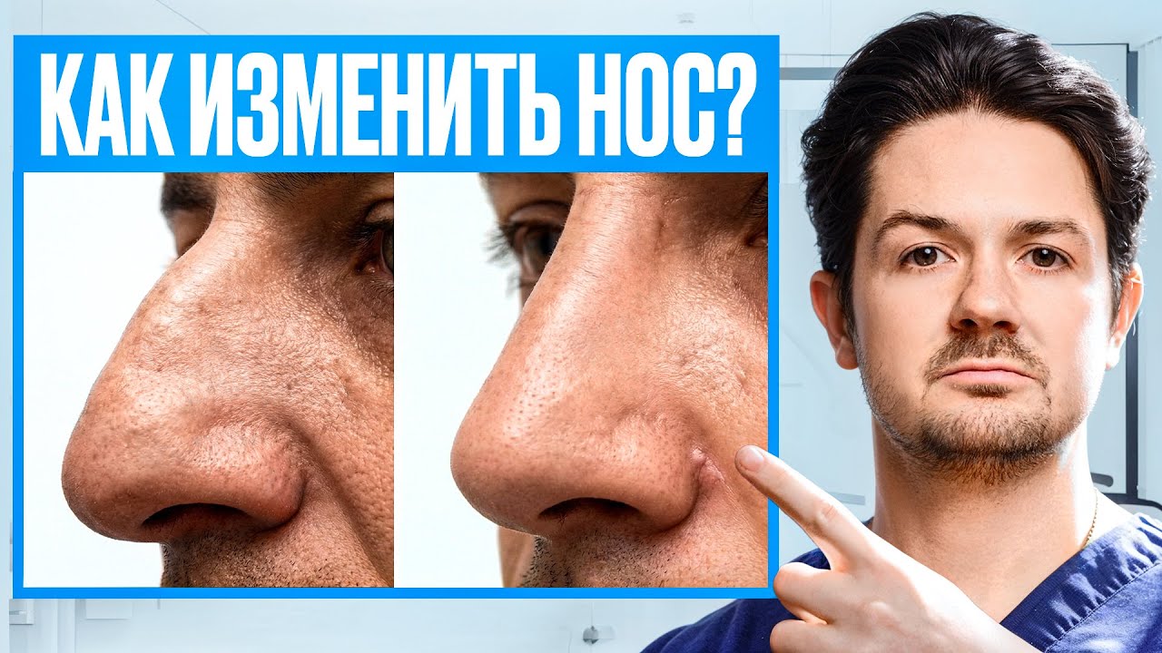 Ринопластика: что на самом деле происходит во время операции?