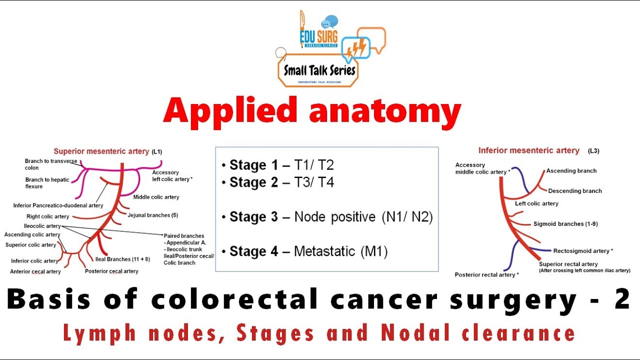 Applied anatomy - colon cancer surgery - cancer stages, Nodal grouping - AJCC 8 - Edusurg Clinics
