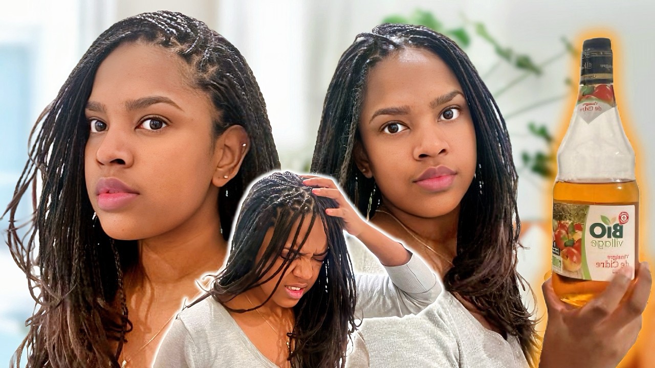 Pourquoi mes tresses grattent ? REM&Egrave;DE maison pour le cuir chevelu qui d&eacute;mange