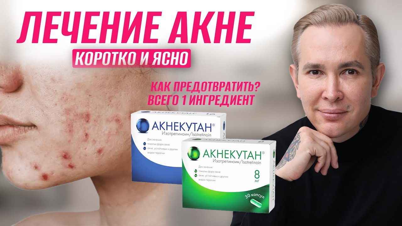 ЛЕЧЕНИЕ АКНЕ коротко и ясно | Комедоклакстин #акне #анекутан 
