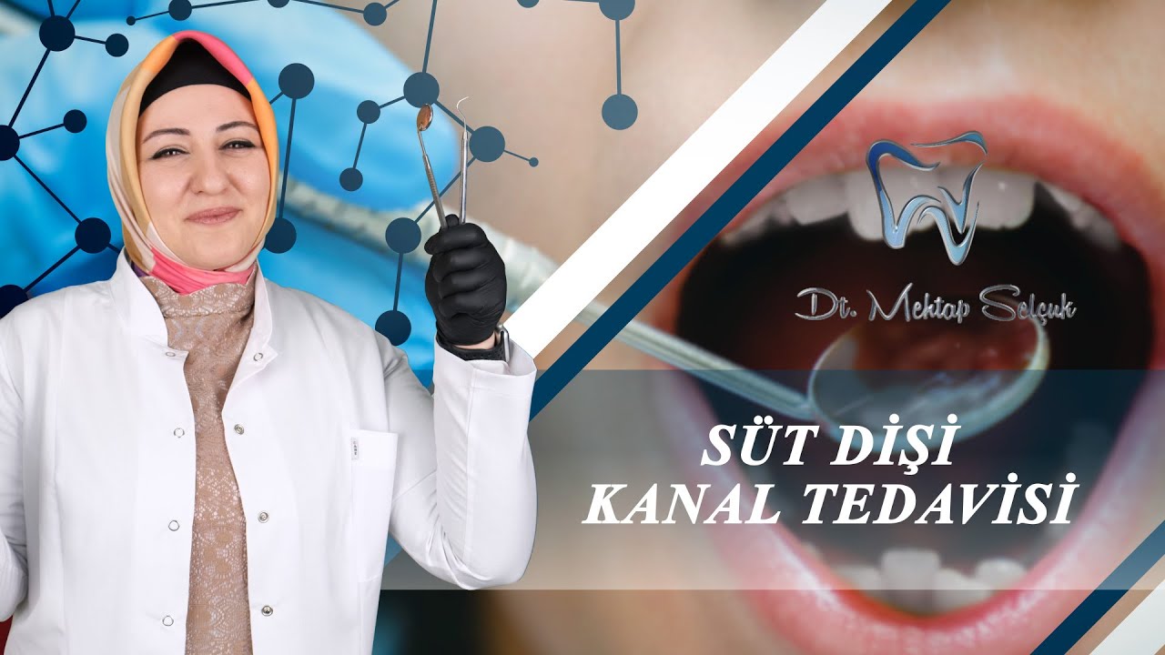 Süt Dişi Kanal Tedavisi