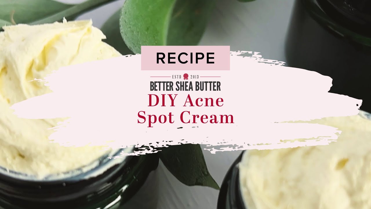 DIY Acne Spot Cream | Home Remedy for Acne with only 4 Natural Ingredients