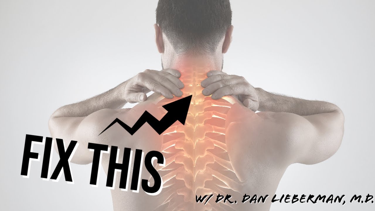 How To Cure Your Neck Pain (WITHOUT Surgery)