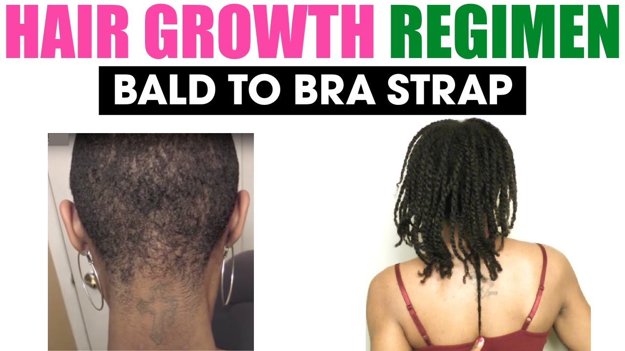 FULL Hair Growth Regimen - Alopecia & Damage | Wash Day
