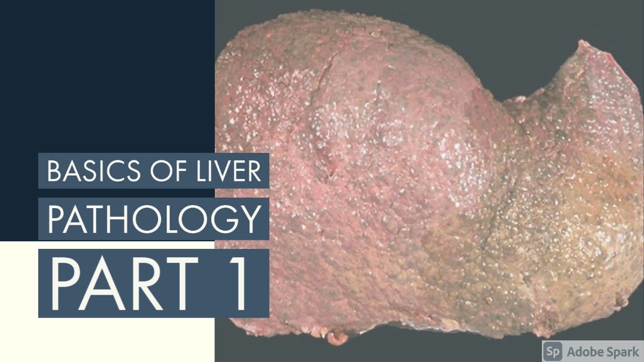 📚 BASICS OF LIVER PATHOLOGY II PART 1 II SYSTEMIC PATHOLOGY II LIVER II ROBBINS 10TH EDITION