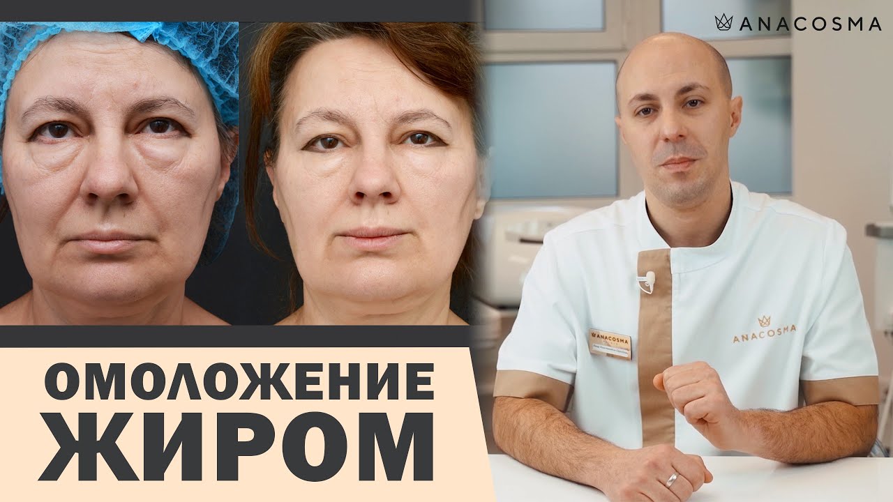 НАНОЛИПОФИЛИНГ VS ЛИПОФИЛИНГ ЛИЦА: ОМОЛОЖЕНИЕ ЖИРОМ 💉🔥 ЧТО ЛУЧШЕ?