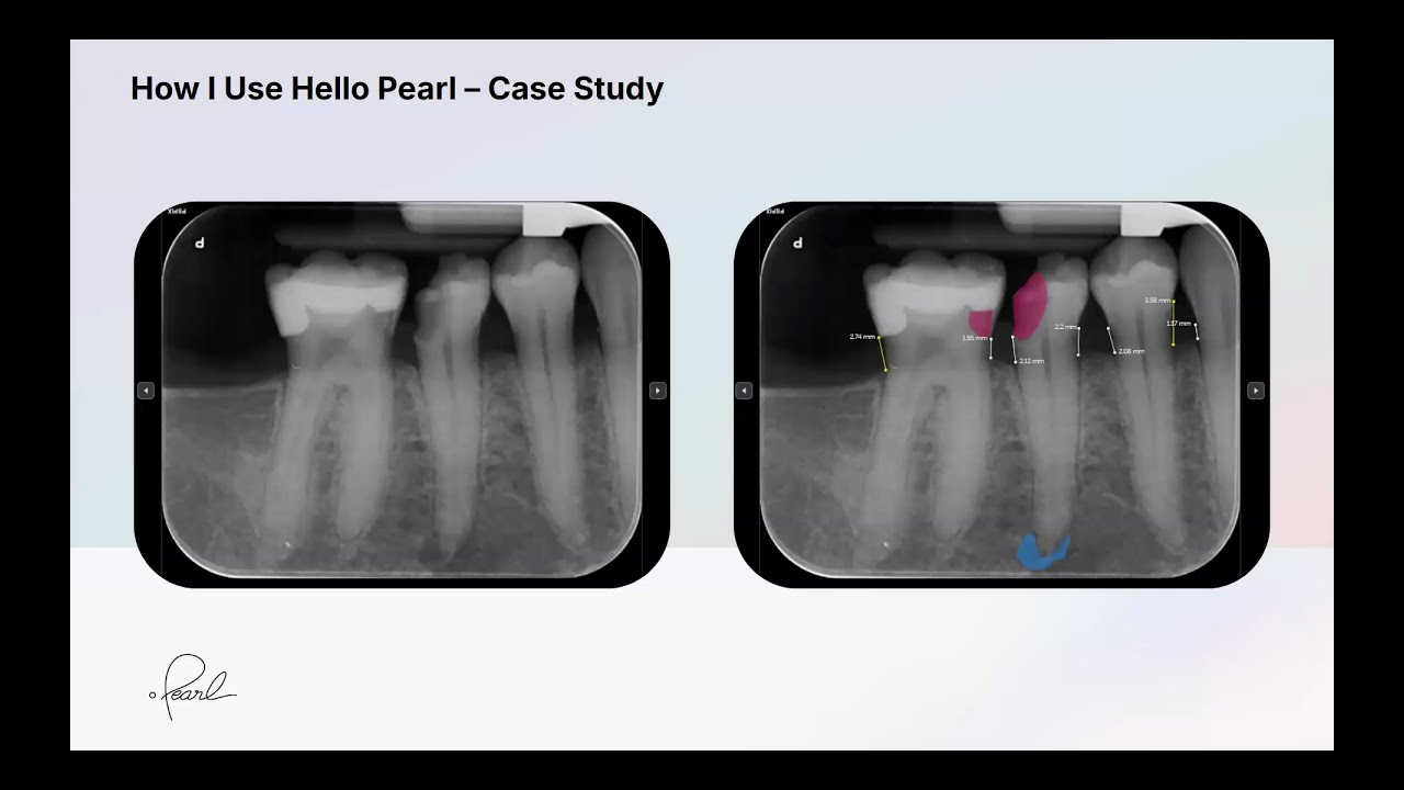 AI for the Modern Dental Group: Elevating Endodontic and Restorative Care