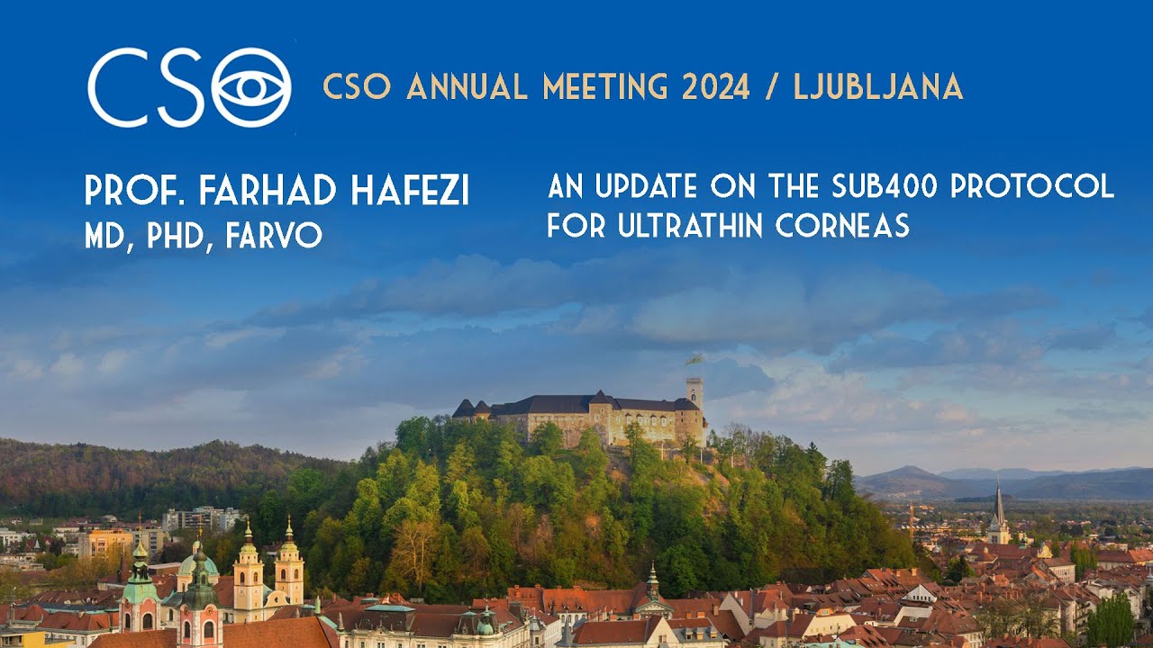 AN UPDATE ON THE SUB400 PROTOCOL FOR ULTRATHIN CORNEAS