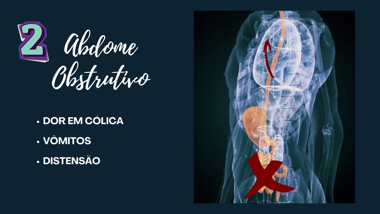 Título: Abdome Agudo — Diagnóstico, Conduta e Raciocínio Clínico na Urgência