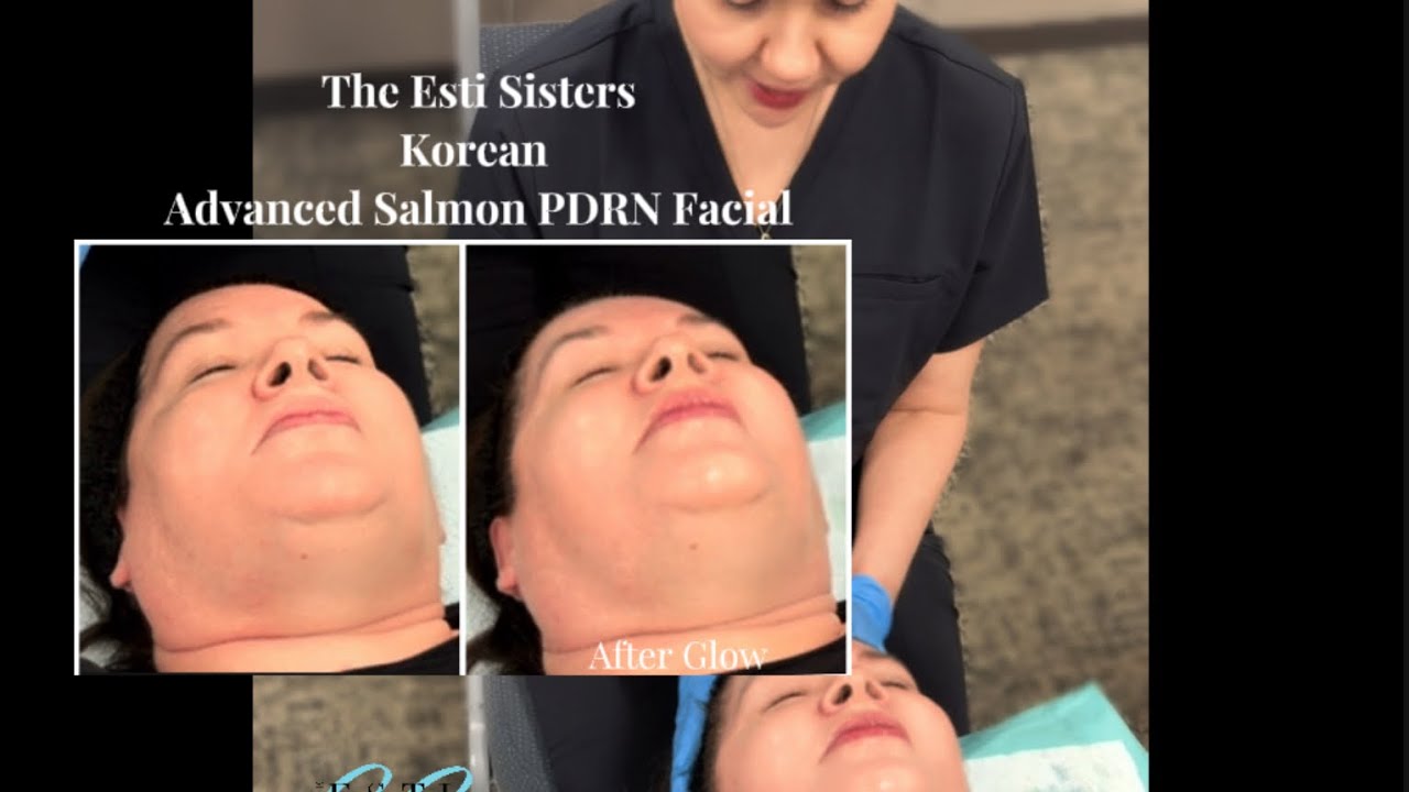  Advanced Salmon PDRN Facial | Korean Science Behind Skin Repair & Renewal