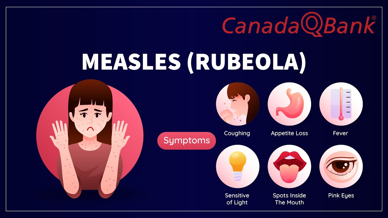 Measles (Rubeola): Symptoms, Complications & Prevention | High-Yield Pediatrics & Infectious Disease