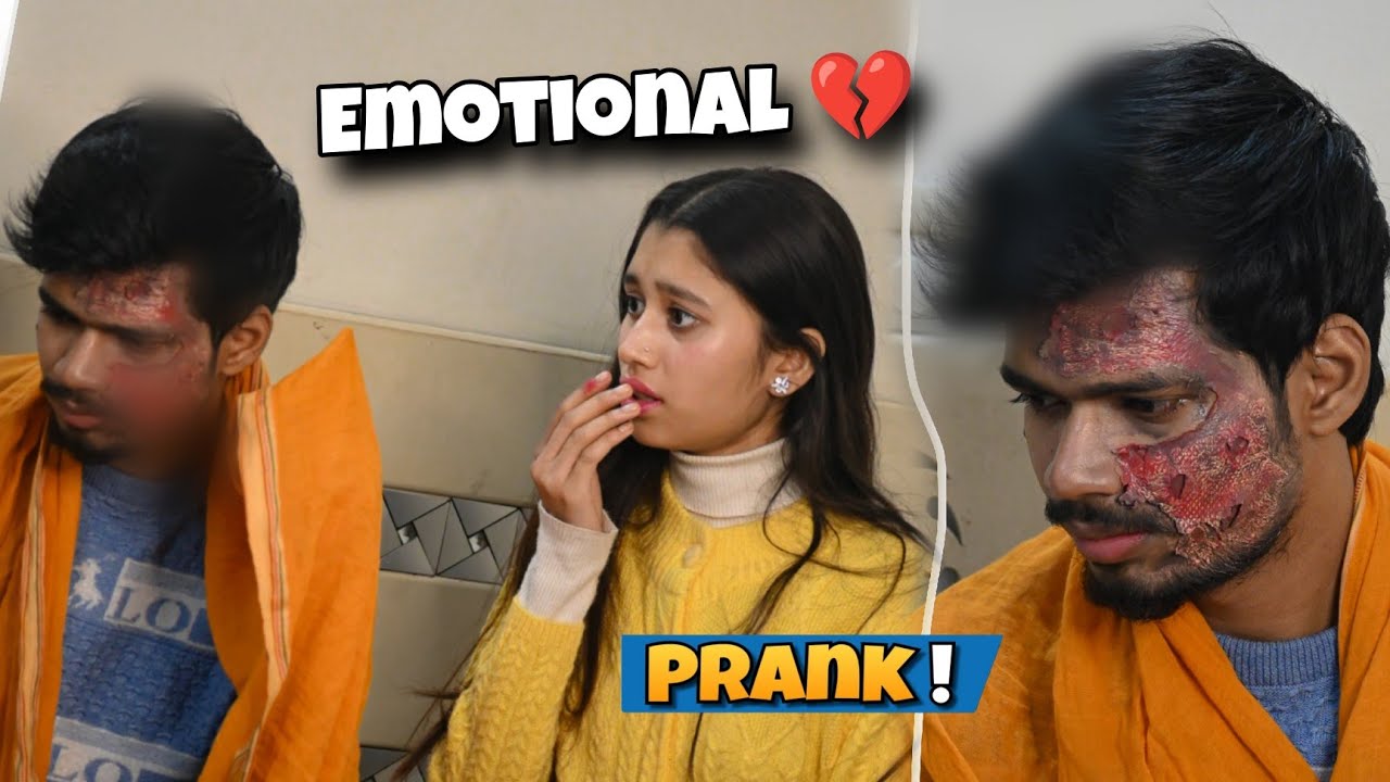 Burning Face Prank On Naina 💔 | Mr Adi