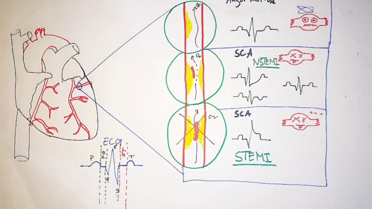 les biomarqueurs cardiaques