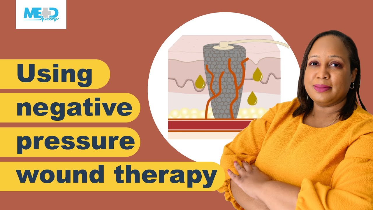 How to Optimize Healing with Negative Pressure Wound Therapy: A Step-by-Step Guide