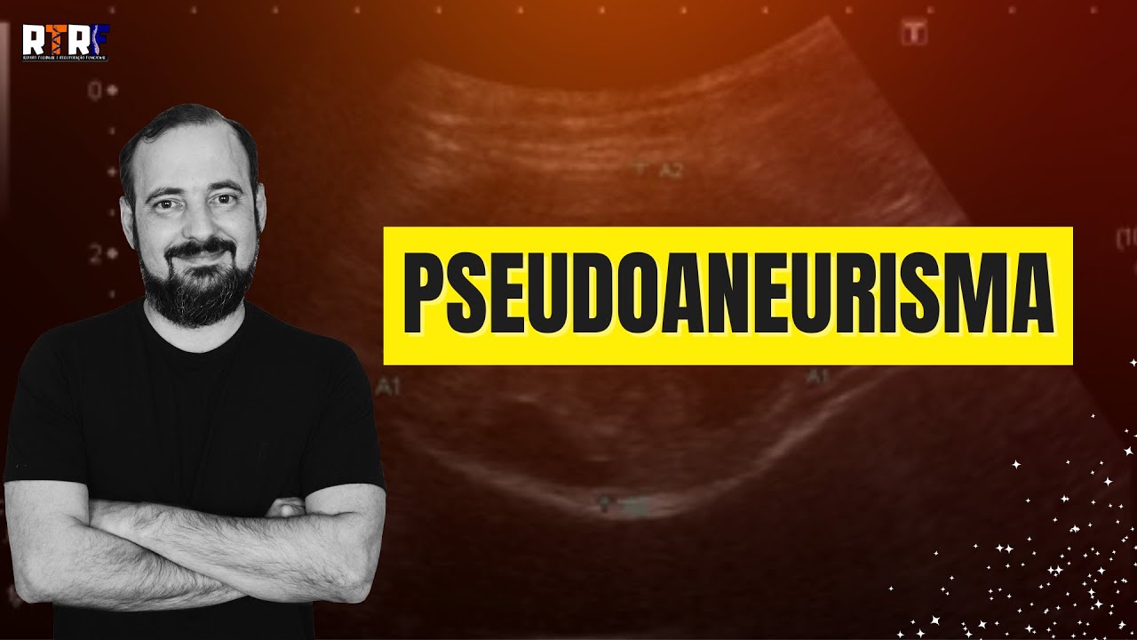 Pseudoaneurisma | José Góes