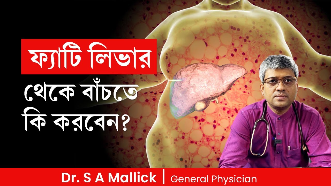 ফ্যাটি লিভার প্রতিরোধের উপায় | How to prevent Fatty Liver | Dr. S A Mallick