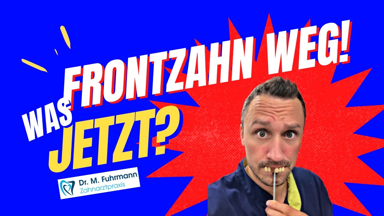 Frontzahn weg 😟 Was jetzt 🤷 | Zahnarzt Dr. Maximilian Fuhrmann