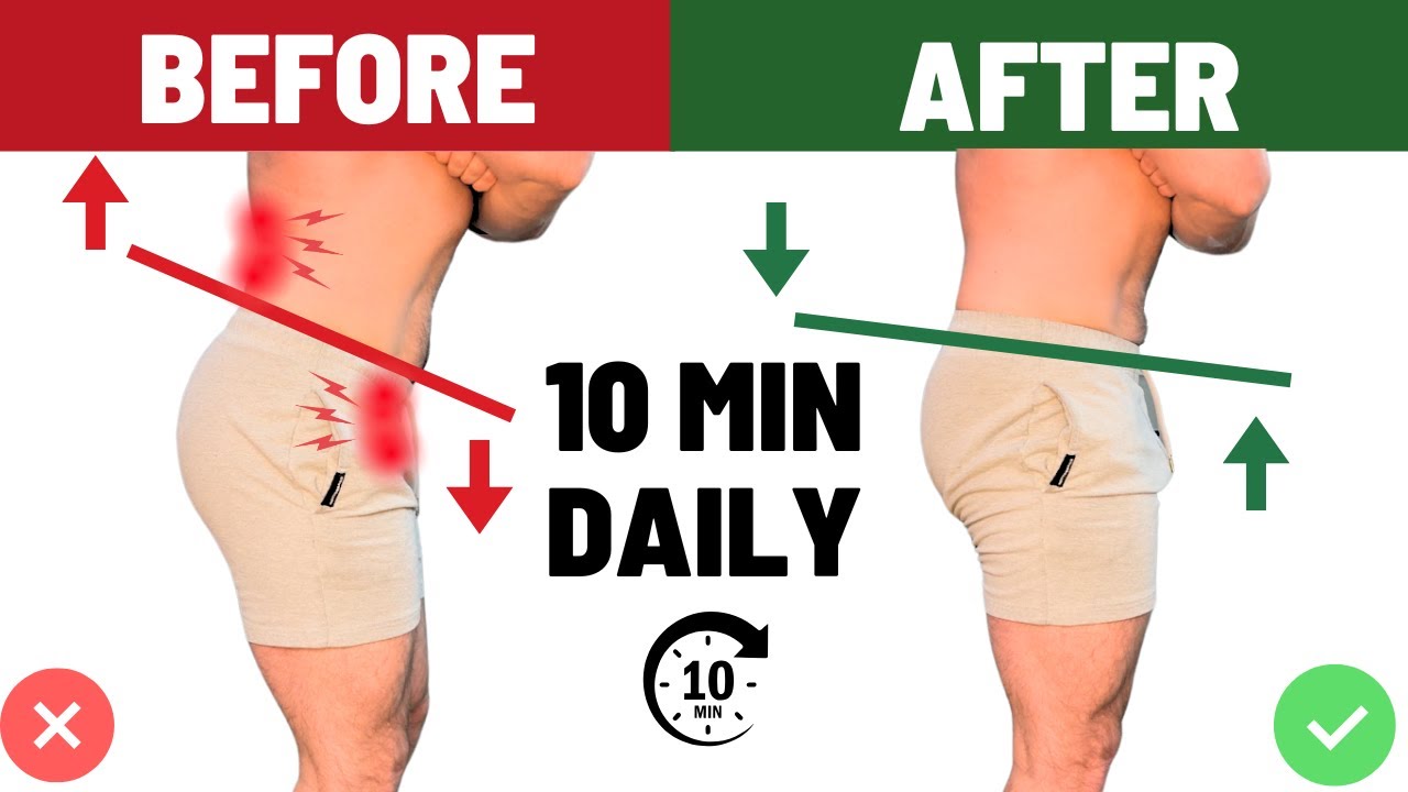 Fix Anterior Pelvic Tilt Forever | 3 Game-Changing Drills