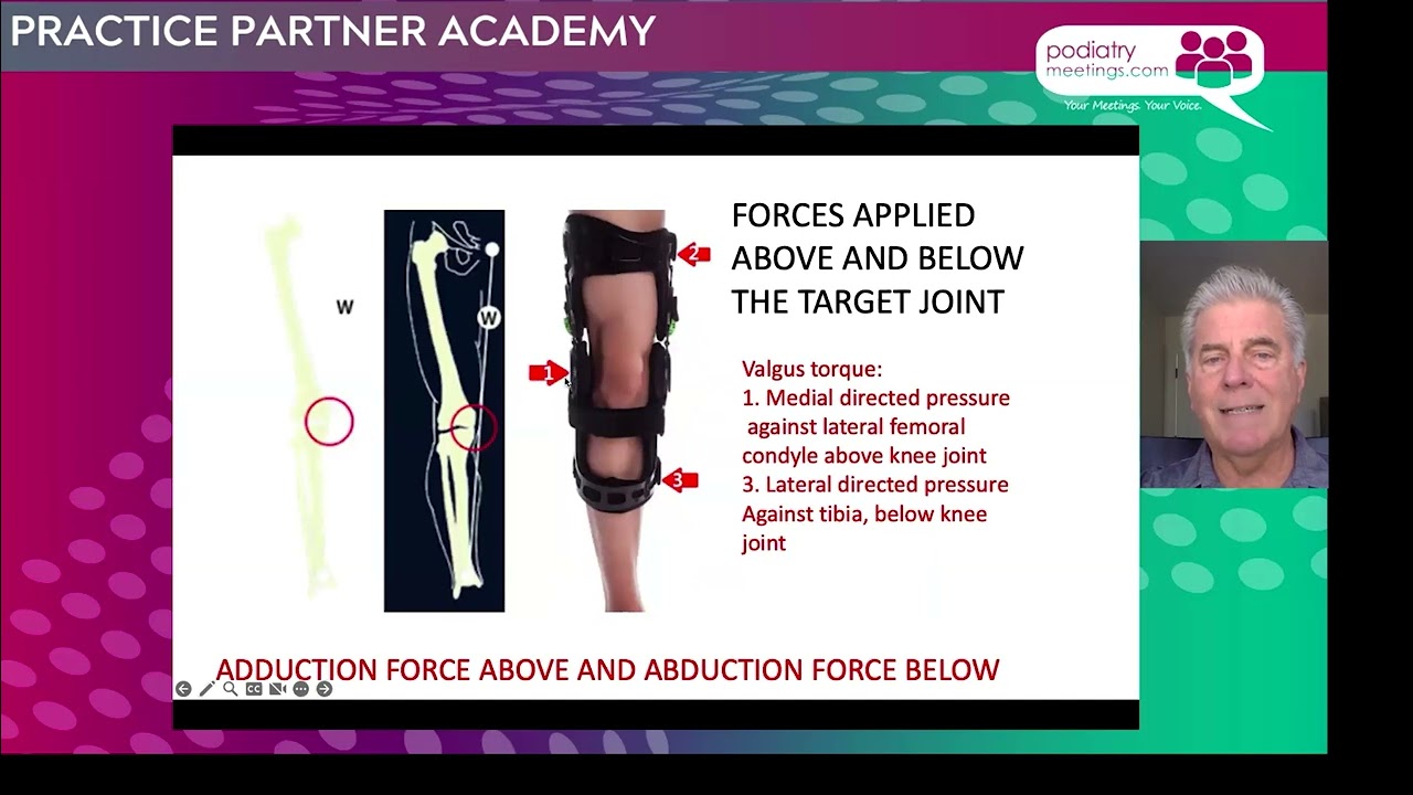 Offloading the Arthritic Ankle with the Richie Brace®