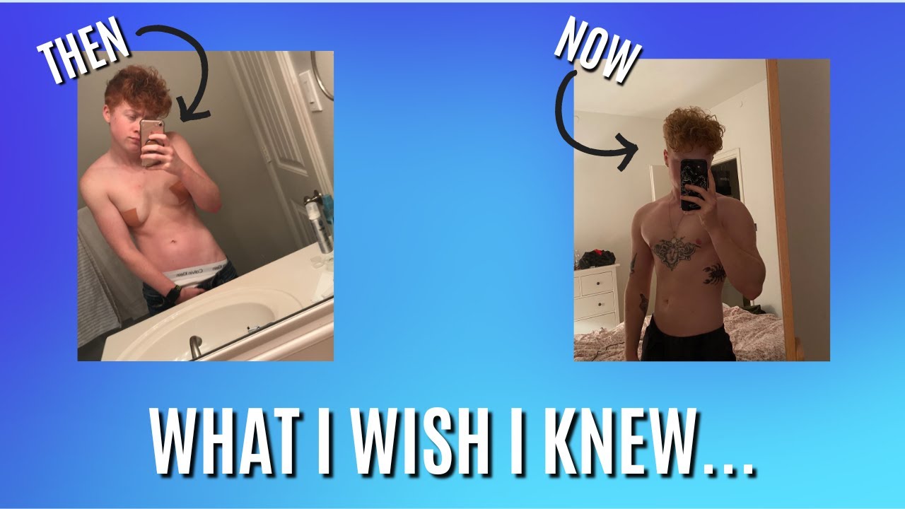 3 THINGS I WISH I KNEW ABOUT TOP SURGERY