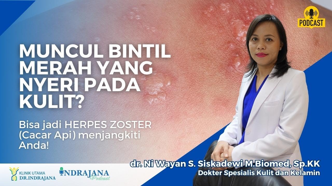 Bintil merah yang nyeri pada kulit? Hati-hati HERPES ZOSTER! #YouTubeHealth #YouTubeHealthIndonesia