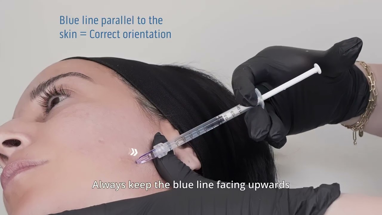 MicronJet™ Best-Practice Guide: Essential Do’s & Don’ts for Intradermal Injections
