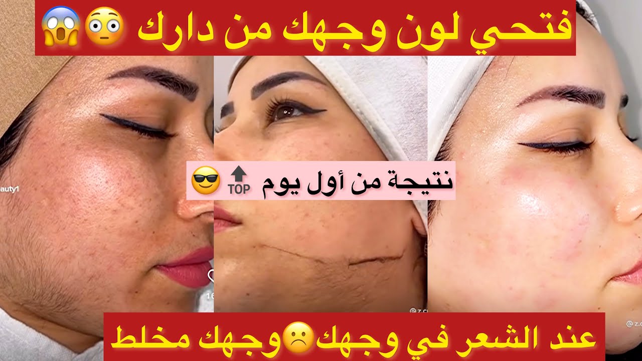 تفتيح وتنظيف الوجه😱غير من دارك😉رجعيه يلمع ويبرق نحي الشعر لي فيه بدون ألم ونتيجة راح تتصدمي🫣🔝