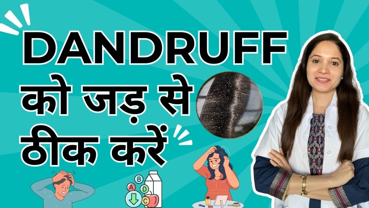 Dandruff को जड़ से ठीक करें