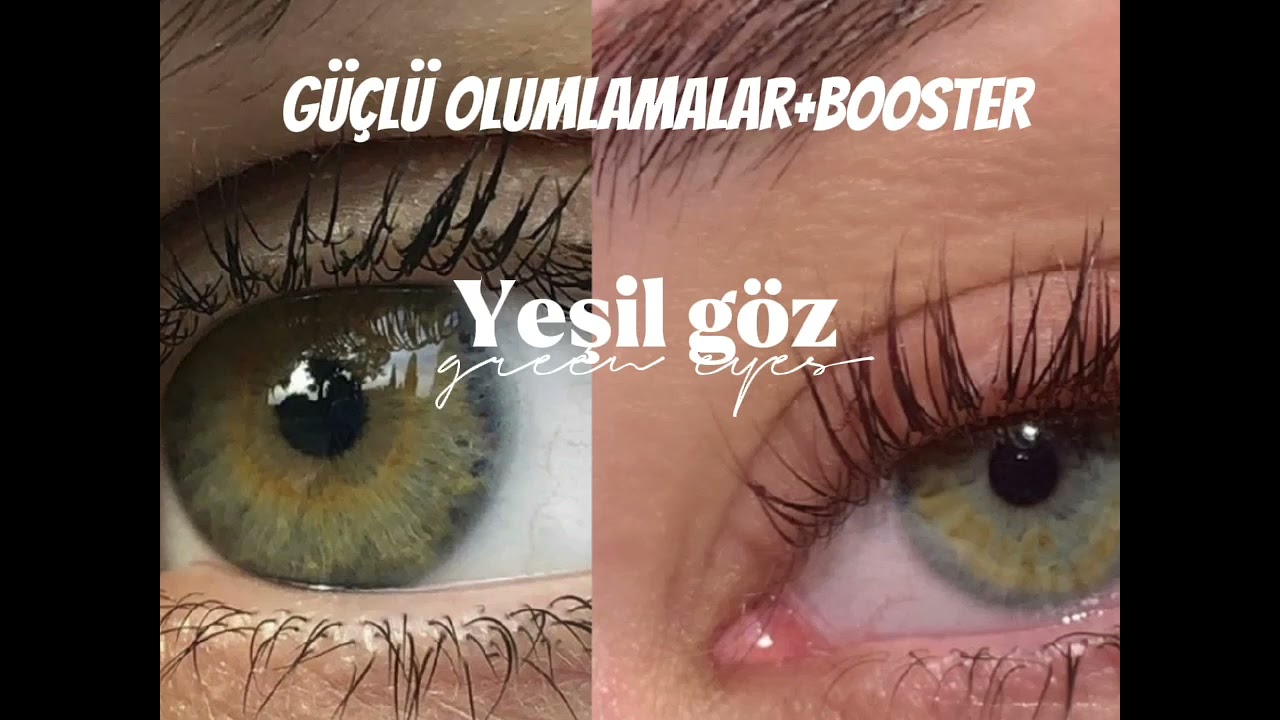 𝒀𝒆𝒔̧𝒊𝒍 𝒈𝒐̈𝒛-𝒈𝒓𝒆𝒆𝒏 𝒆𝒚𝒆𝒔 𝒔𝒖𝒃𝒍𝒊𝒎𝒊𝒏𝒂𝒍💚/𝙶𝚞̈𝚌̧𝚕𝚞̈ 𝚘𝚕𝚞𝚖𝚕𝚊𝚖𝚊𝚕𝚊𝚛+𝙱𝚘𝚘𝚜𝚝𝚎𝚛🌳