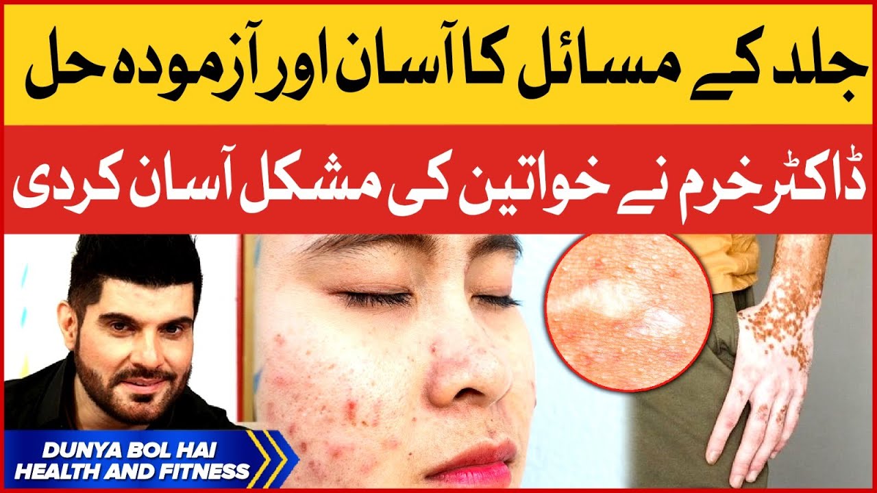 Skin Problems Simple Solution | Acne and Blackheads | Dr Khurram Easy Tips | Breaking News