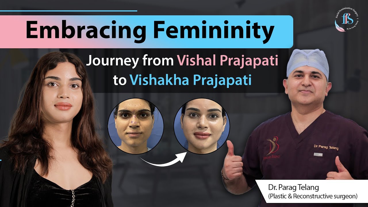 MTF Transformation | Vishal to Vishakha Facial Feminization Surgery Journey