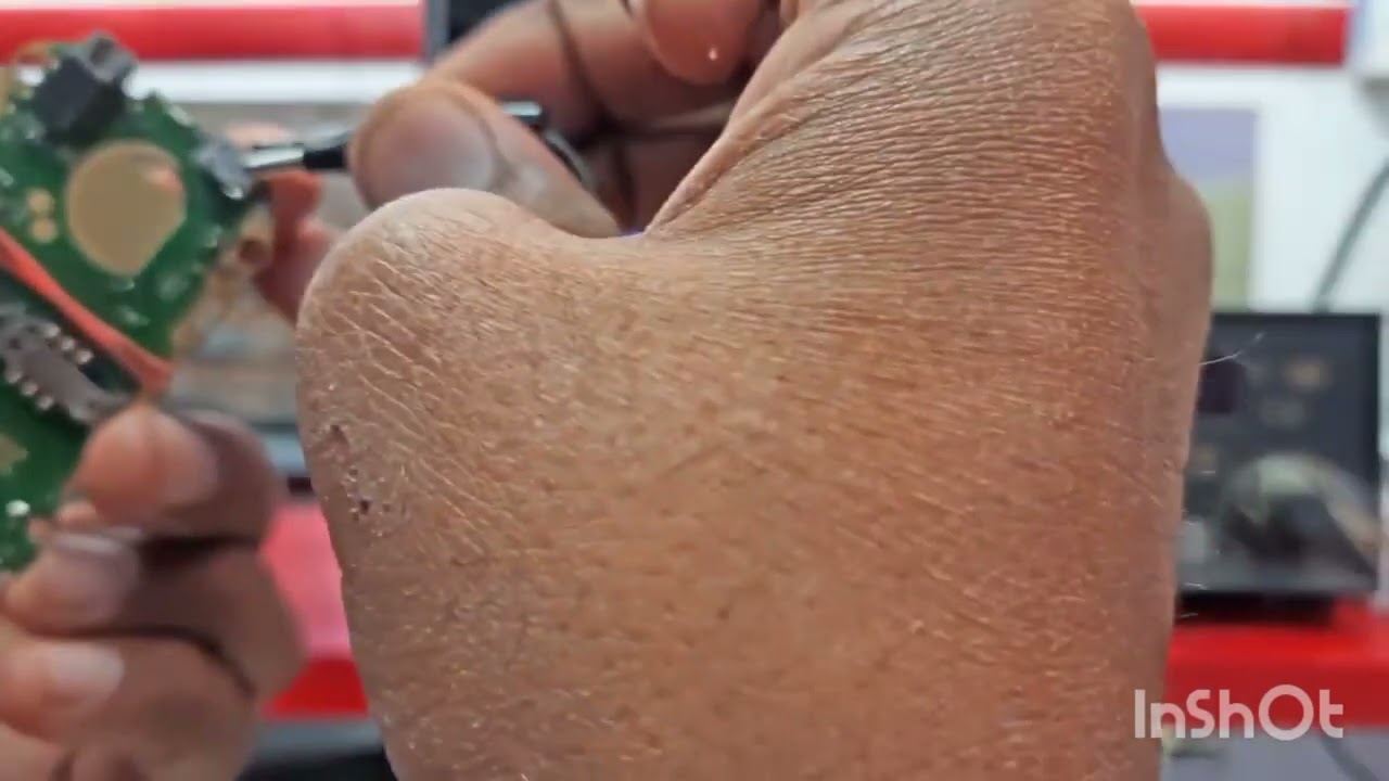 Nokia 106 shots solution