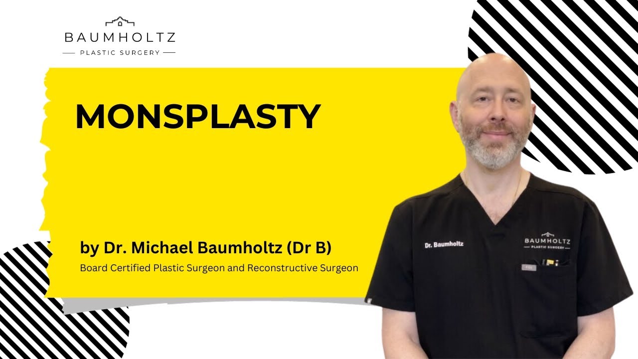 MONSPLASTY