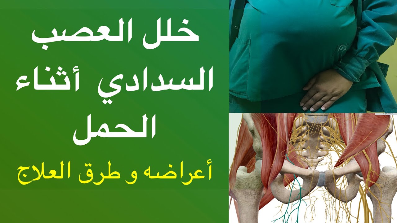 ‏خلل العصب السدادي أثناء الحمل أعراضه وطرق العلاج