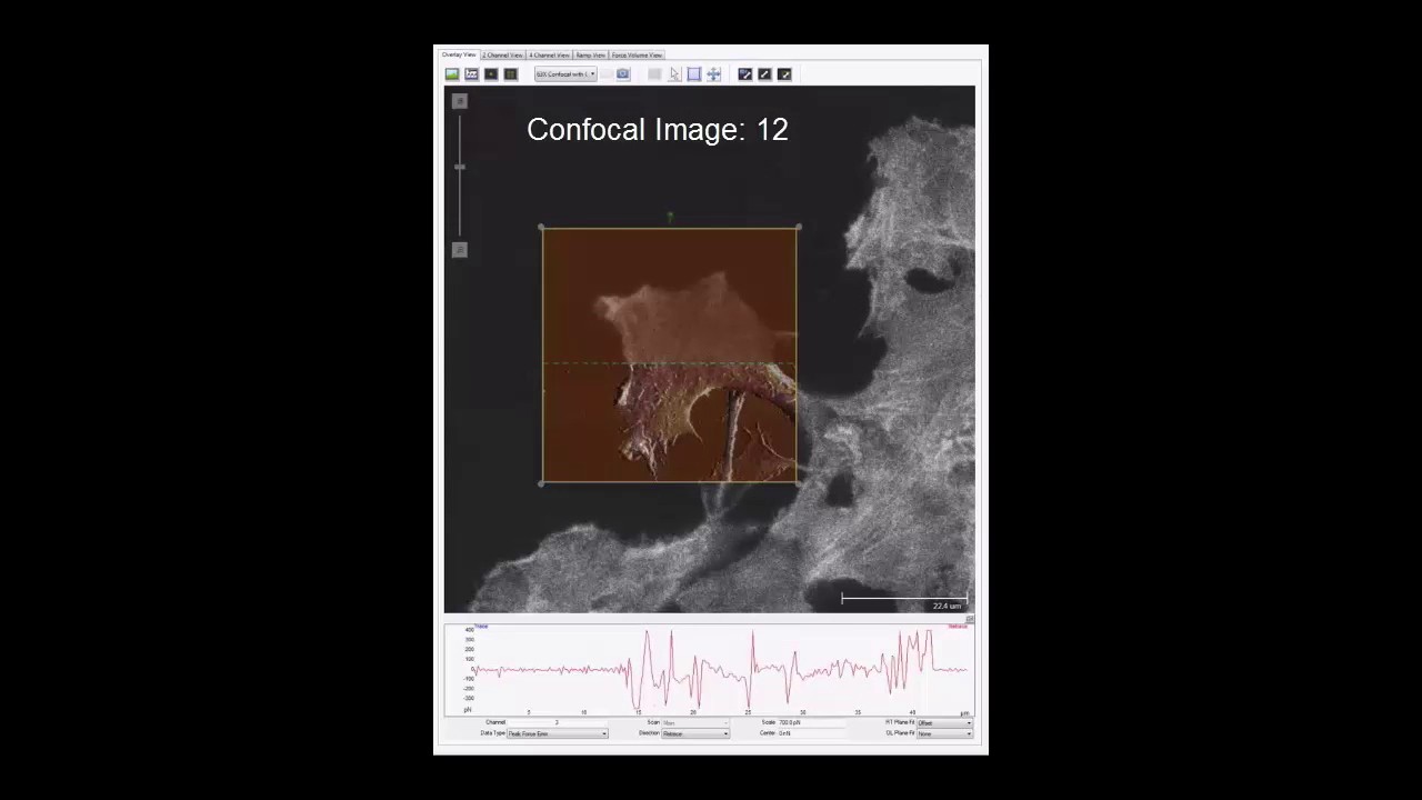 AFM | BioScope Resolve Seamless Optical Microscopy and AFM integration | Bruker