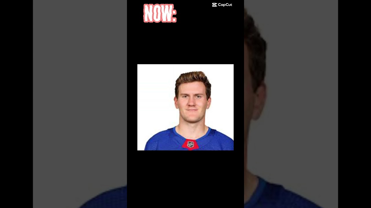 Adam Fox Then VS Now