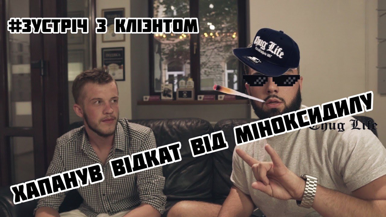 Хапанув ВІДКАТ від Міноксидилу! #ЗУСТРІЧЗКЛІЄНТОМ