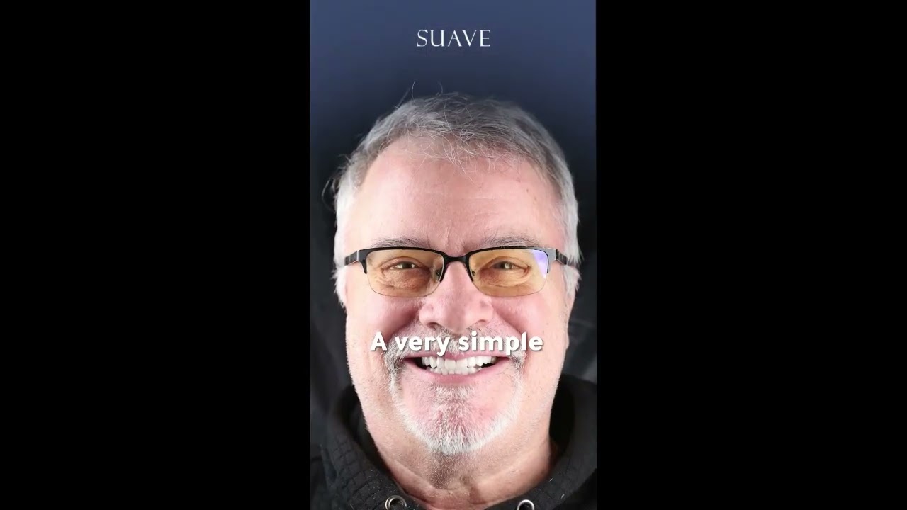 Crown placement at Suave Clinic with Dr. Imad Alboshi in Turkey