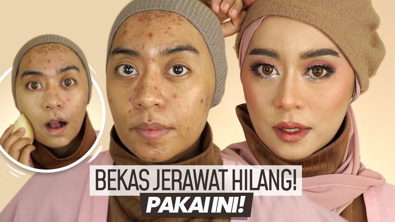 HILANG TUH JERAWAT HITAM! TUTORIAL MAKEUP UNTUK MENCOVER BEKAS JERAWAT