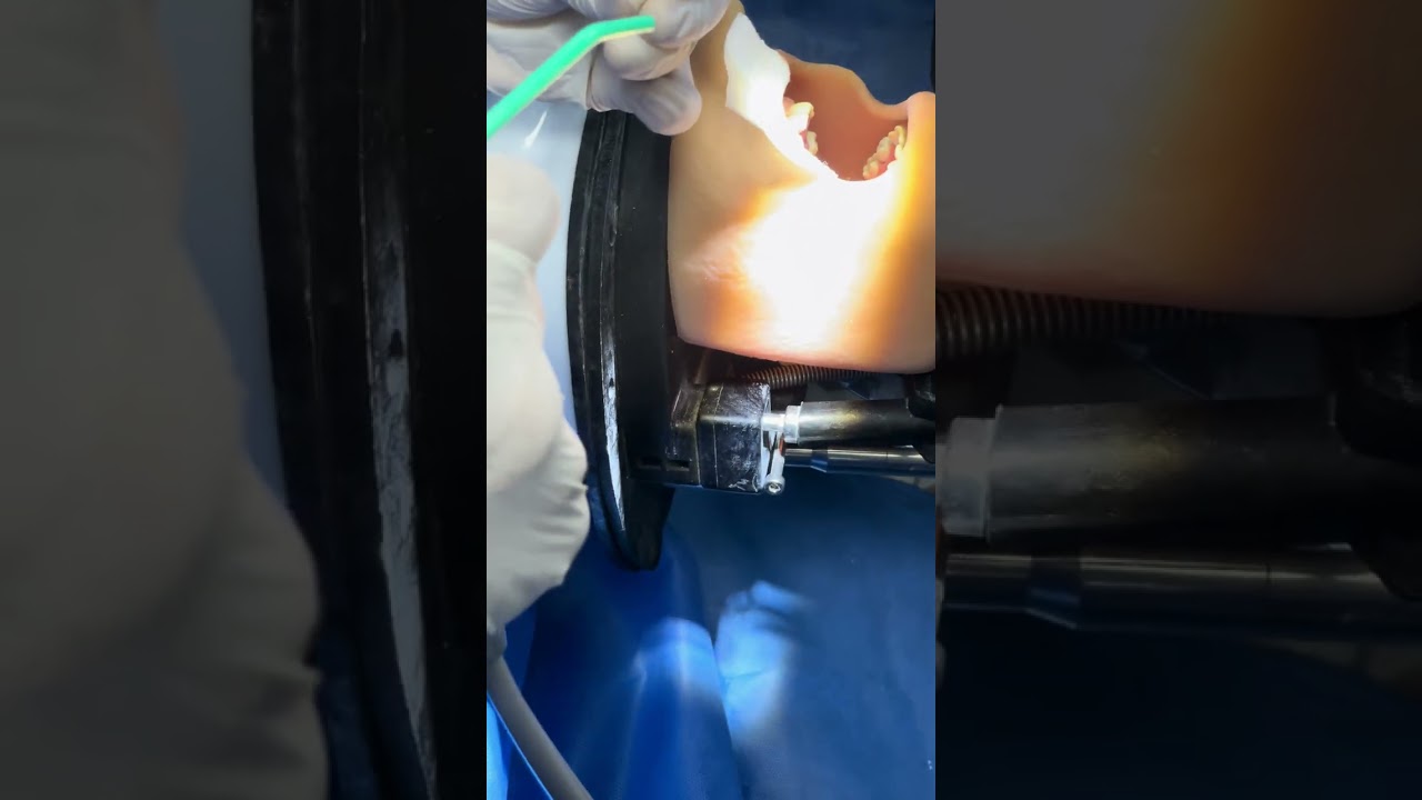 Corona celuloide 02