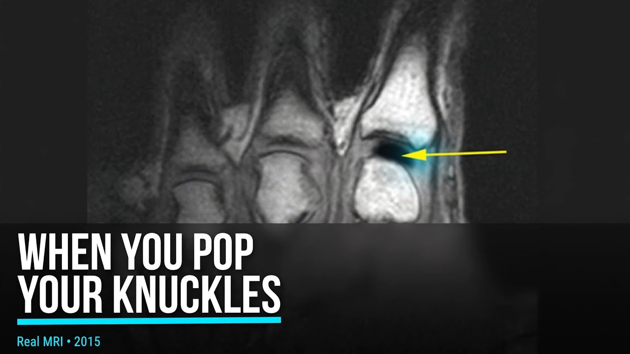 Why do our knuckles make a popping sound when cracked?