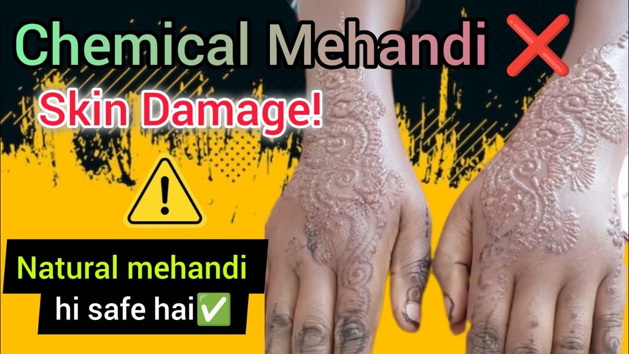 Chemical mehndi ke side effects⚠️ | Reels me dikhi hairaan karne wali sachhai😱