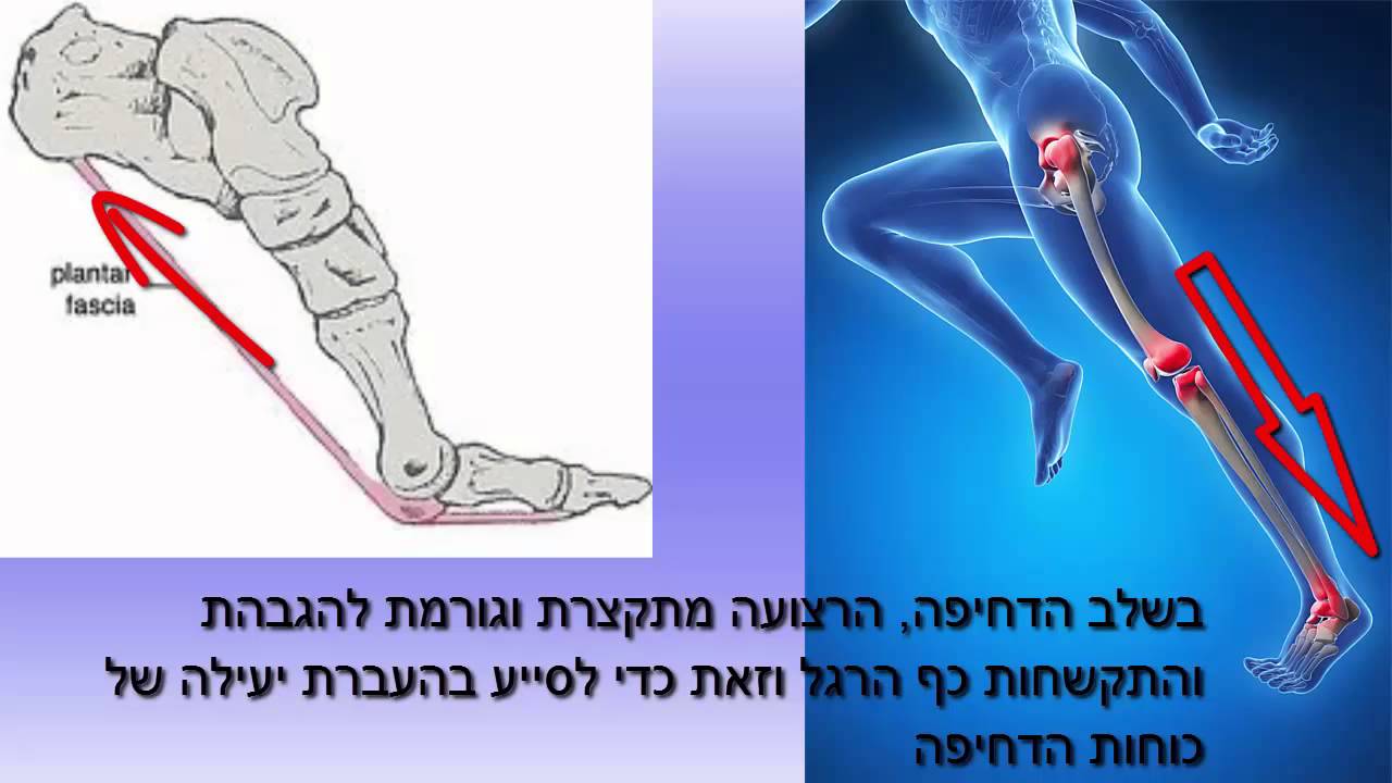 דורבן - טיפול בכאבי  ופציעות כף רגל ד