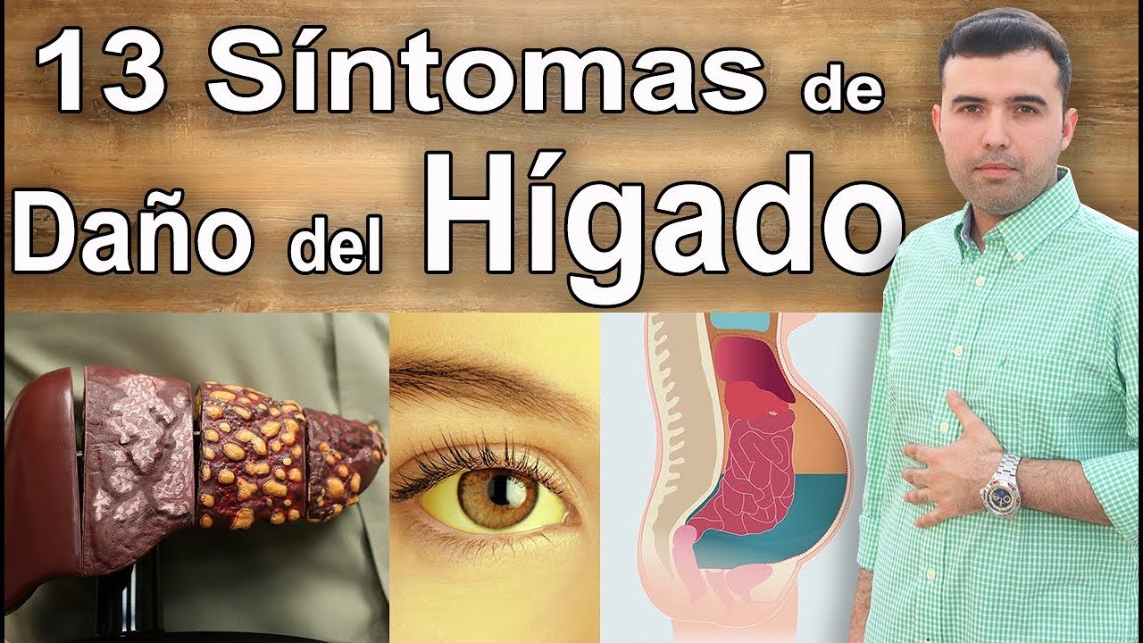 Hígado Dañado - 13 Síntomas Que Puedes Tener Daño Hepático